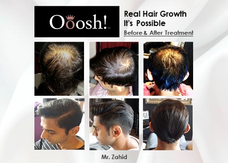 Ooosh! Real Hair Growth Is Possible